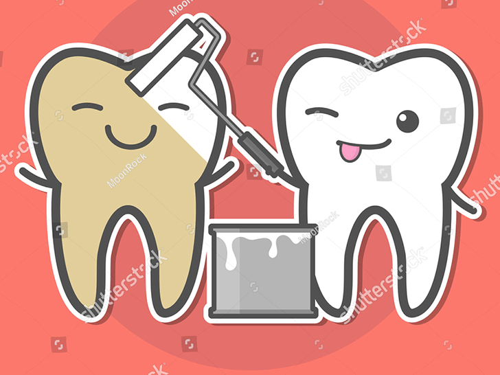  Teeth Whitening, colombo , wellawatta